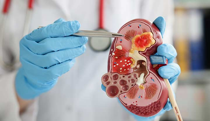 nephrology treatement center in alappuzha
